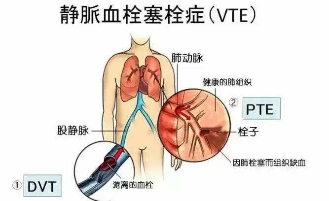 11e1d95e4b5e415d_html_4a9534e52b0fa059